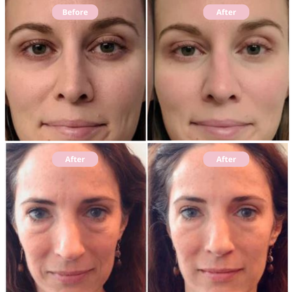 Peptide Collagen Hydrogel Eye - Averna Skin 